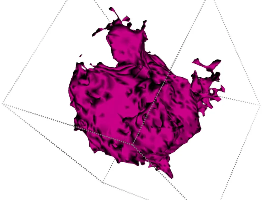 True 3D breast imaging captured by QT ultrasound